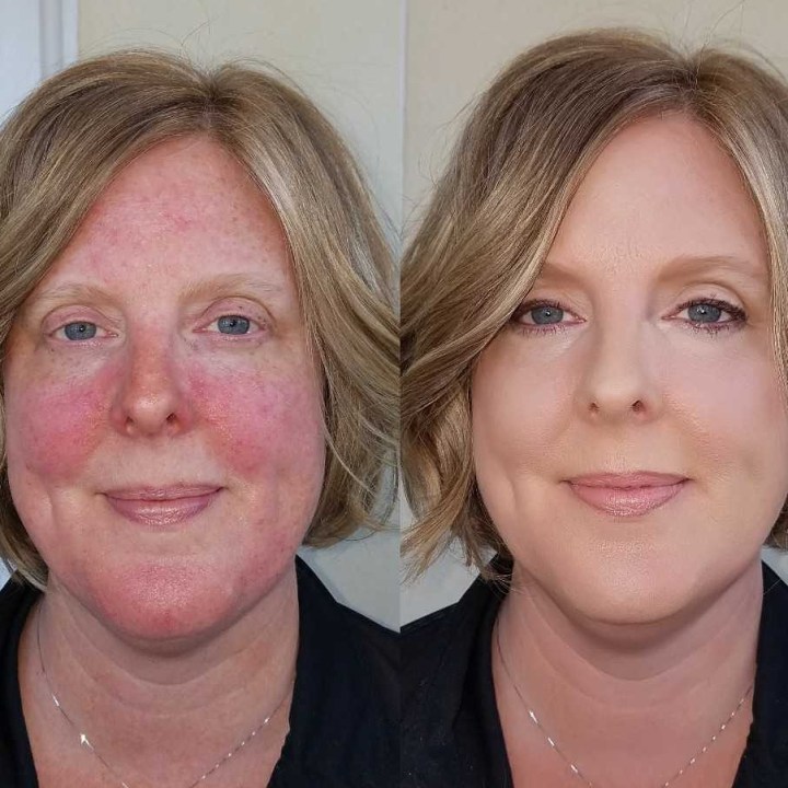 photo-20171027034032